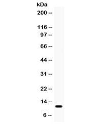 Western blot testing of human Jurkat cell lysate with CCL3 antibody. Expected molecular weight: 11/8