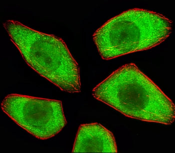 STRADA Antibody / LYK5