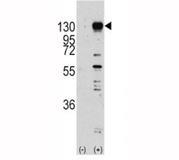 Western blot analysis of FGF receptor antibody and 293 cell lysate (2 ug/lane) either nontransfected