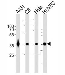 GAPDH antibody WB at 1:1000 dilution. Lane 1: A431 lysate; 2: rat C6; 3: HeLa; 4: HUVEC; Predicted b
