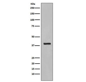 Western blot testing of human HepG2 cell lysate with Cytokeratin 19 antibody. Expected molecular wei
