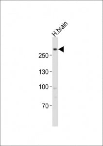 LRRK2 Antibody