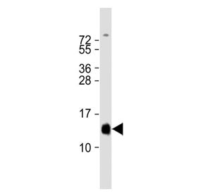 Western blot testing of human fetal heart tissue lysate with HBA2 antibody. Predicted molecular weig