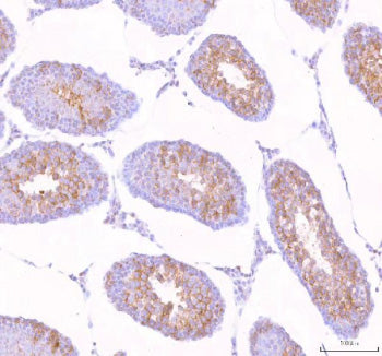 Immunohistochemical staining of STK31 using anti-STK31 antibody. STK31 was detected in a paraffin-em