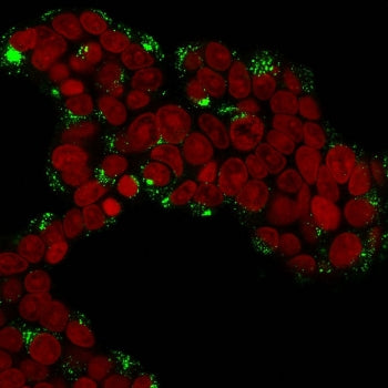 Immunofluorescent staining of permeabilized human MCF7 cells with Cathepsin D antibody (clone CTSD/3