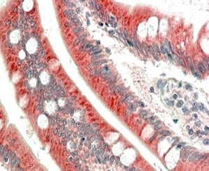 MIC1 Antibody