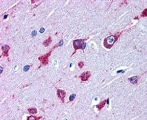 IHC testing of FFPE human cortex with ALS2 antibody at 4ug/ml. HIER: steamed with pH6 citrate buffer