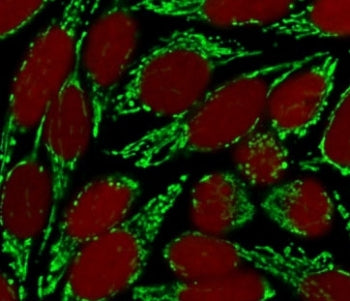 HSP60 Antibody