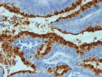 Blood Group Lewis b Antibody / FUT3