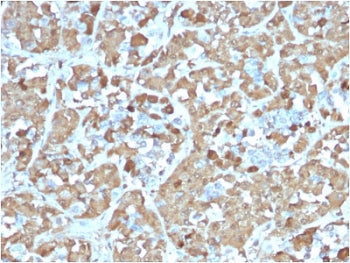 IHC testing of FFPE human pituitary gland with recombinant GH antibody (clone rGH/1450). Required HI