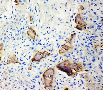 IBSP Antibody / Bone Sialoprotein 2