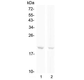 Western blot testing of human 1) Raji and 2) Jurkat cell lysate with BCMA antibody at 0.5ug/ml. Expe