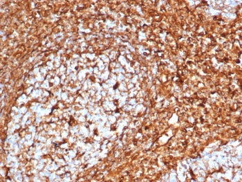 IHC staining of FFPE human tonsil tissue with recombinant Vimentin antibody (clone VIM/6576R). HIER: boil tissue sections in pH 9 10mM Tris with 1mM EDTA for 20 min and allow to cool before testing.