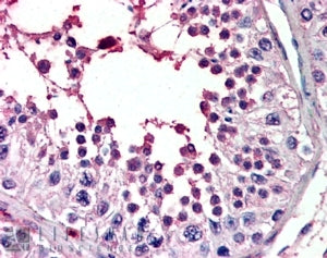 IHC testing of FFPE human testis with PIAS2 antibody at 4ug/ml. HIER: steamed with pH6 citrate buffe