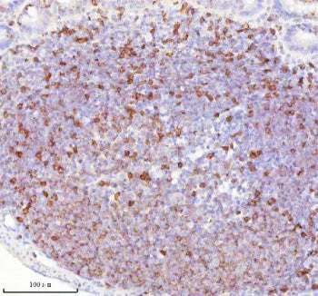 Immunohistochemical staining of Lat using anti-Lat antibody. Lat was detected in a paraffin-embedded