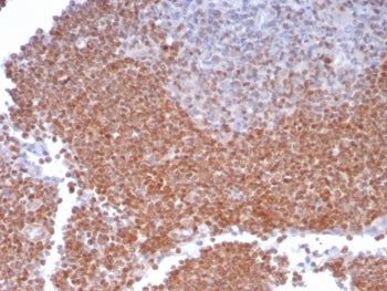 IHC staining of FFPE human lymph node tissue with MGMT antibody (clone MGMT/8186R). HIER: boil tissu