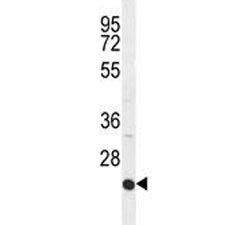 ICAM2 antibody western blot analysis in HepG2 lysate. Expected molecular weight: 31-60 kDa depending