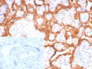 Growth Hormone Antibody / GH1