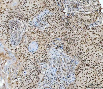 RNF2 Antibody / RING1B / RING2