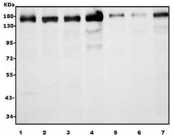 Western blot testing of human 1) HeLa, 2) HepG2, 3) Caco-2, 4) HEK293, 5) MDA-MB-453, 6) PANC-1 and 