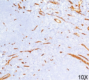 IHC testing of human tonsil (10X) stained with CD34 antibody (QBEnd/10).