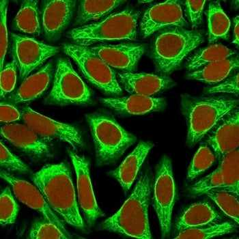 Cytokeratin 18 Antibody