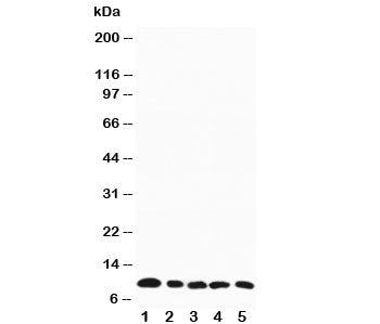 Western blot testing of MIP-1 beta antibody and mouse samples: 1. spleen, 2. heart, 3. lung, 4. kidn