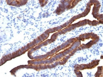 MUC1 Antibody / Mucin-1