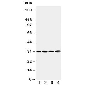 Western blot testing of SOD3 antibody and Lane 1: human placenta; 2: A549; 3: MM231; 4: MCF-7 cell l