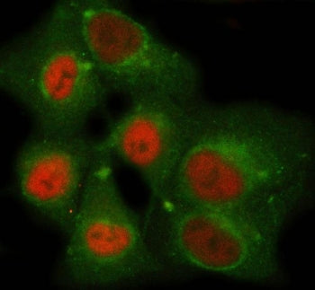 Immunofluorescent staining of FFPE human A549 cells with NEMF antibody (red) and Beta Tubulin mAb (g