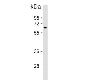 Western blot testing of human K562 cell lysate with MTMR9 antibody. Predicted molecular weight ~63 k