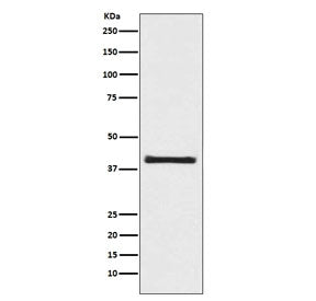 Western blot testing of human 293T cell lysate with AKT1S1 antibody. Expected molecular weight ~40 k