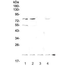 Western blot testing of rat 1) liver, 2) kidney, 3) spleen and 4) brain lysate with Cd59 antibody at