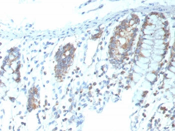 IHC staining of FFPE human colon tissue with recombinant CD151 antibody (clone CD151/9297R). HIER: b