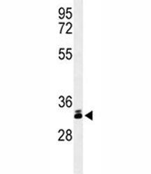 DKK-1 Antibody