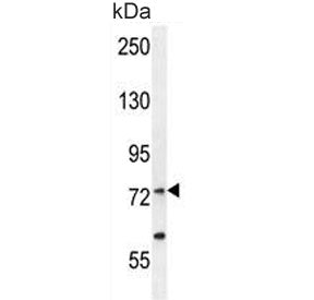 Western blot testing of human MCF7 cell lysate with RARS antibody. Predicted molecular weight ~75 kD