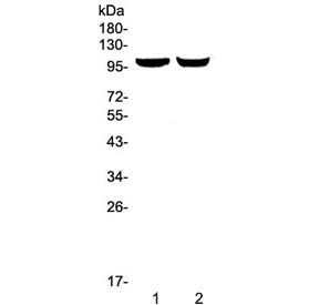 Western blot testing of 1) rat brain and 2) mouse brain lysate with Dynamin 2 antibody at 0.5ug/ml. 