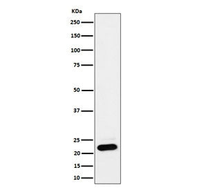 Western blot testing of human HEK293 cell lysate with NDUFB9 antibody. Predicted molecular weight ~2