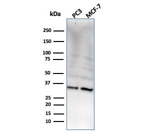 Western blot testing of human PC-3 and MCF-7 cell lysate with NKX2.8 antibody. Predicted molecular w