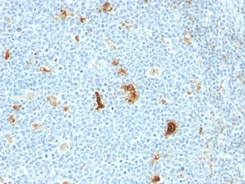 Macrophage Antibody / S100A8/A9 / Calprotectin