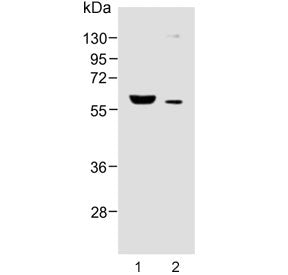 Western blot testing of human 1) breast and 2) liver lysate with FADS2 antibody. Predicted molecular