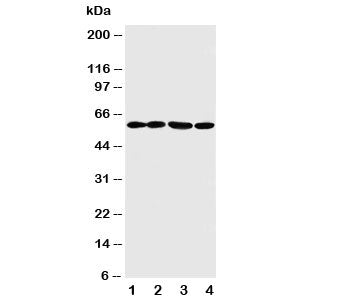 Western blot testing of ANGPTL1 antibody and Lane 1: A549; 2: SW620; 3: MCF-7; 4: MM231 cell lysate