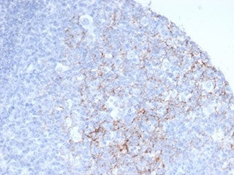 IHC staining of FFPE human tonsil tissue with CD23 antibody (clone FCER2/6888). HIER: boil tissue se