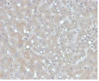 IHC staining of FFPE human liver tissue with Apolipoprotein B antibody (clone APOB/4335). HIER: boil