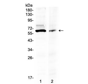 AMH Antibody (Muellerian Hormone)
