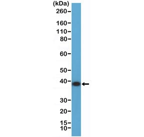 Western blot testing of human K562 cell lysate with recombinant ANXA1 antibody at 1:2000 dilution. P