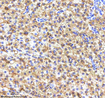 IHC staining of FFPE zebrafish liver tissue with Fasn antibody, HRP-labeled secondary and DAB substr