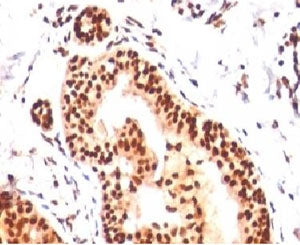 IHC analysis of human tonsil with SUMO2/3 antibody (clone S23MT-1). Required HIER: boil tissue secti