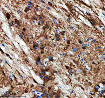 IHC staining of FFPE zebrafish brain tissue with Zebrafish Opa1 antibody. HIER: boil tissue sections