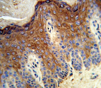 IHC testing of FFPE human skin tissue with ALOX12 antibody. HIER: steam section in pH6 citrate buffe
